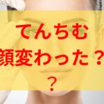 てんちむの顔変わって劣化してる？元の顔や若い頃と比較！